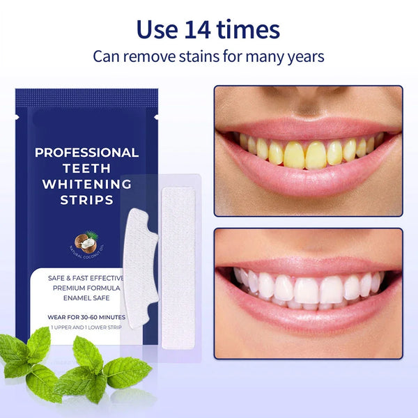 🔥🔥Today's promotion 48%🔥🔥Teeth Whitening Strips