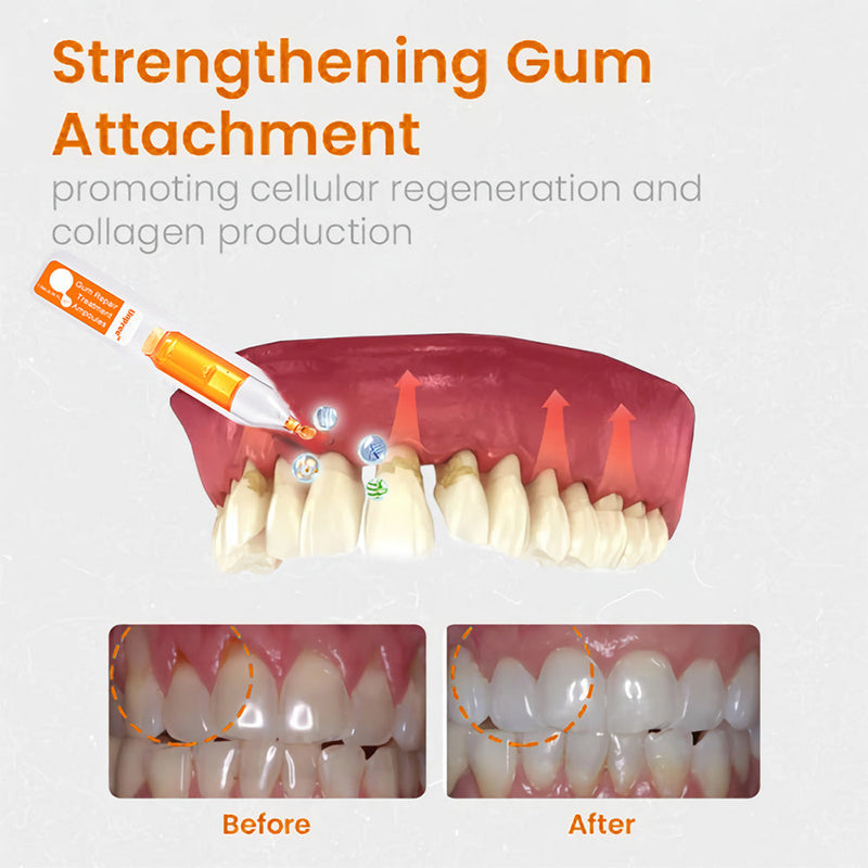 Gum Repair Treatment Ampoules