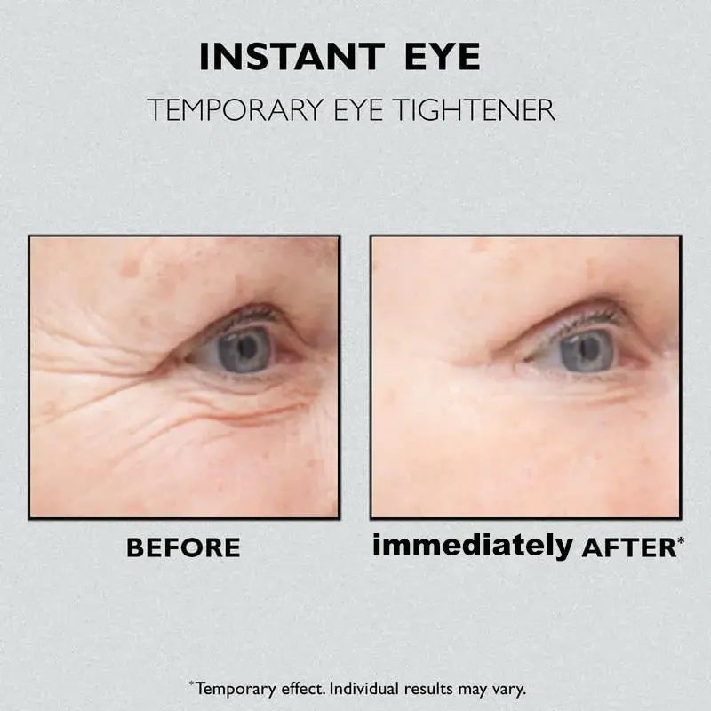 🔥Last Day Sale 50% OFF🔥 Instant Eye Temporary Eye Tightener(✨Buy 2 Get 1 Free💕)