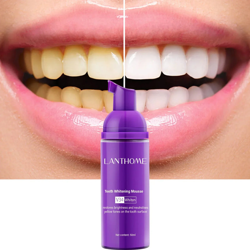 V34✨Bright Smile Saver Mousse Toothpast