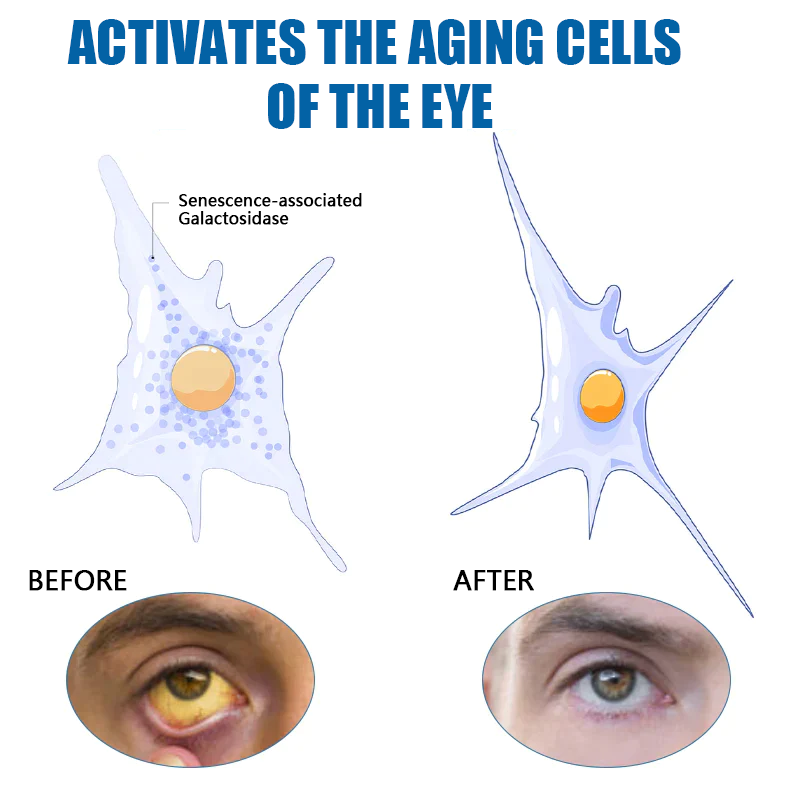 🔥Ourlyard™ Eye drops for treating vision issues