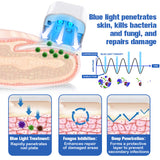 Nail Fungus Laser Therapy Device