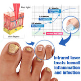 Nail Fungus Laser Therapy Device