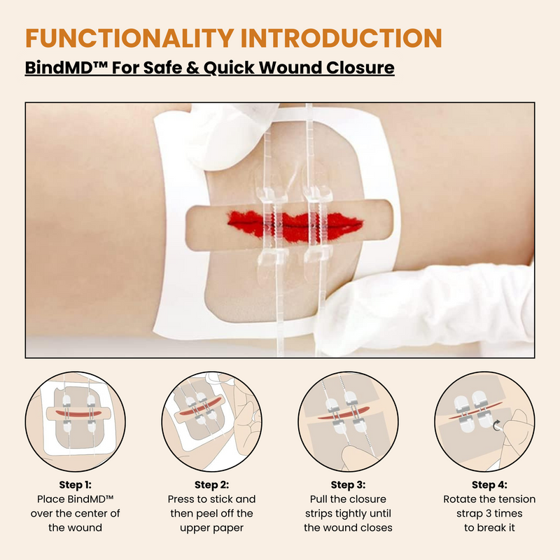 Wound Closure Device