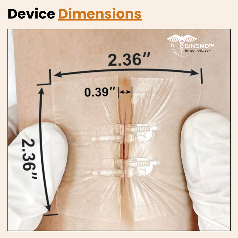 Wound Closure Device