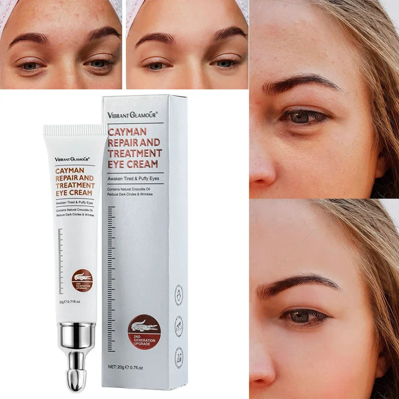 VIBRANT GLAMOUR Anti -Age Wrinkle Eye Cream - BUY 2 GET FREE SHIPPING