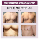 Gynecomastia Oil Spray