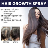 Natural Hair Regrowth Spray