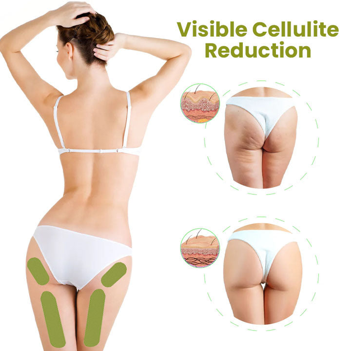 CalesCare℠  Pro Herbal Firm Cellulite Reduction Patches