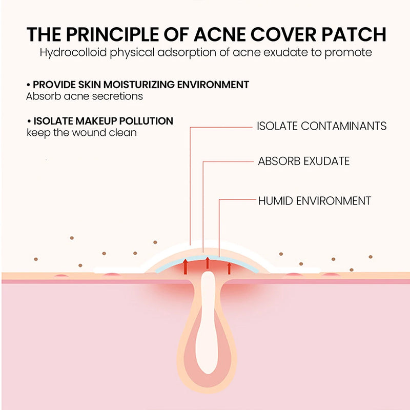 Facial Hydrocolloid Acne Patch