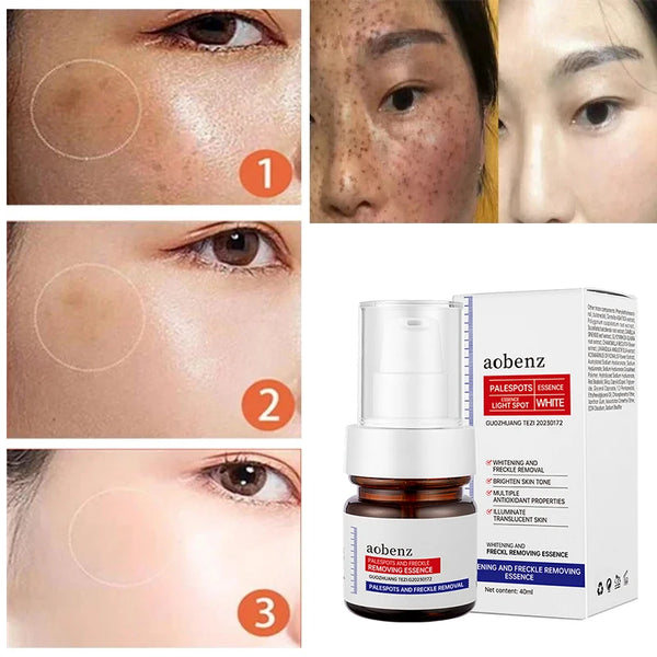 🔥【Limited time offer, buy 1 get 1 free, only $13 each】🔥Vitamin C Whitening Freckles Face Cream Remove Melasma Dark Spots Lighten Melanin