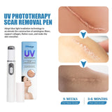 UV PHOTOTHERAPY SCAR REMOVAL PEN