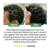 Batana Natural Hair Growth Oil